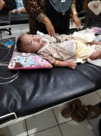Bayi Delapan Bulan di Lombok Tengah Jalani Kontrol Rutin Usai Operasi Hidrosefalus